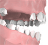 Problem z zębami