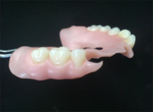 Proteza zębów dolnych